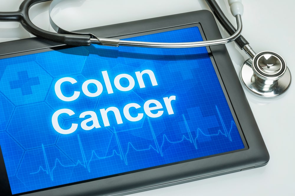 Colon-cancer-treatment
